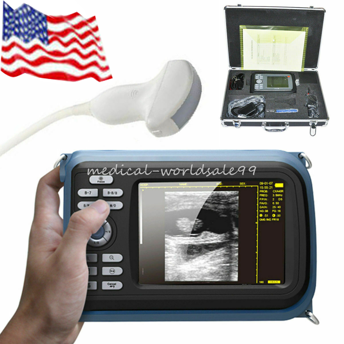 Medical Handheld Ultrasound Scanner Machine With Convex Transducer For Human USA DIAGNOSTIC ULTRASOUND MACHINES FOR SALE