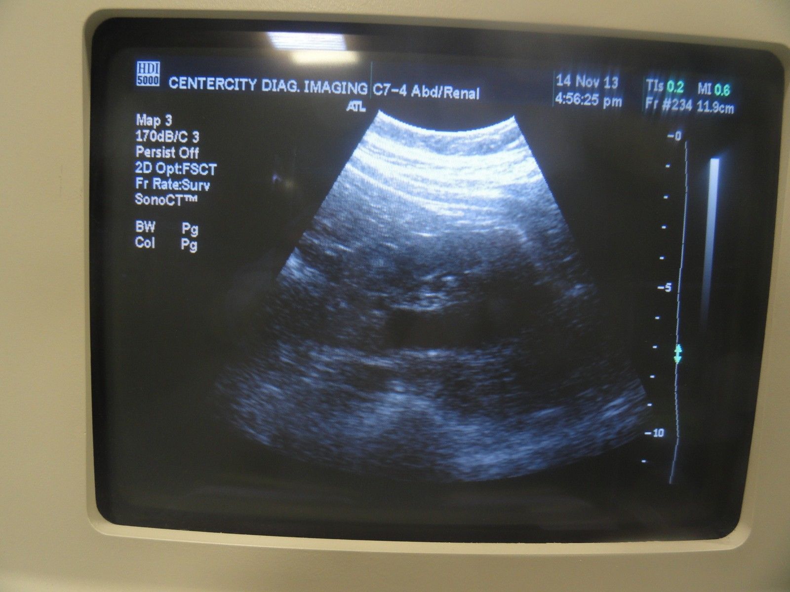 ATL C7-4 40R Curved Array Convex Abdominal Probe for ATL HDI Series (5965 ) DIAGNOSTIC ULTRASOUND MACHINES FOR SALE