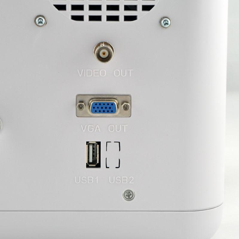 Digital Laptop Ultrasound Scanner Convex & Transvaginal 2Probe 3D Oximeter Sale DIAGNOSTIC ULTRASOUND MACHINES FOR SALE