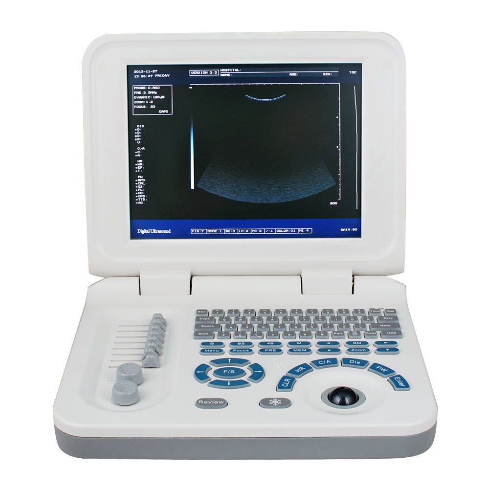 Laptop 10" Ultrasound Scanner Machine + Micro-convex Probe CE 2 Years W & Bag DIAGNOSTIC ULTRASOUND MACHINES FOR SALE