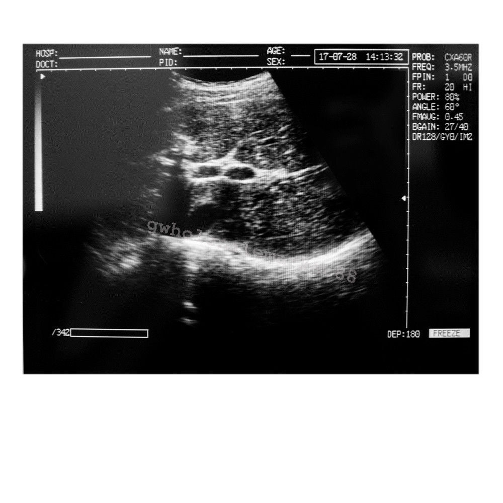 Laptop Ultrasound Machine Scanner Convex Probe 3D Software High Resolution Clear 190891045898 DIAGNOSTIC ULTRASOUND MACHINES FOR SALE