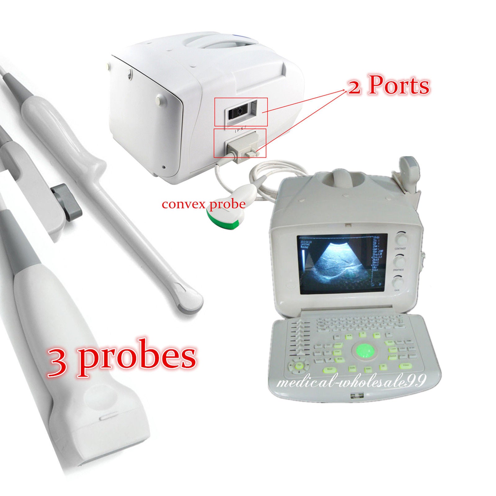 Full Digital Ultrasound Scanner/Machine Convex/Transvaginal 2 Probe USB Port 3D 190891466129 DIAGNOSTIC ULTRASOUND MACHINES FOR SALE