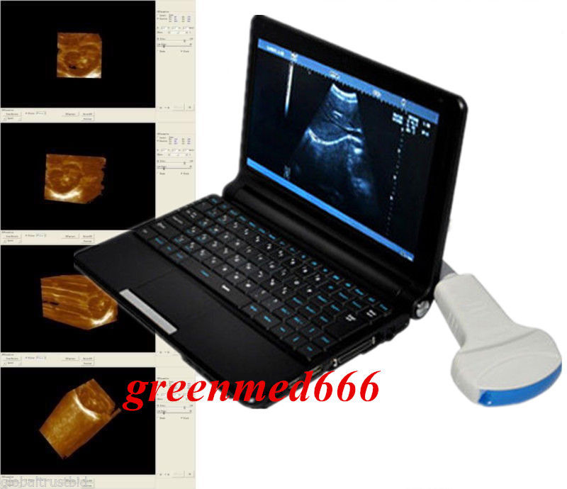Full Digital Quality Images Ultrasound Scanner Convex +Linear Probe 3D Clear CE DIAGNOSTIC ULTRASOUND MACHINES FOR SALE