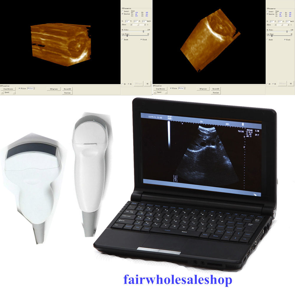 Digital Laptop Ultrasound Scanner/Machine/System convex+micro-convex+3D 2 probes 190891457554 DIAGNOSTIC ULTRASOUND MACHINES FOR SALE