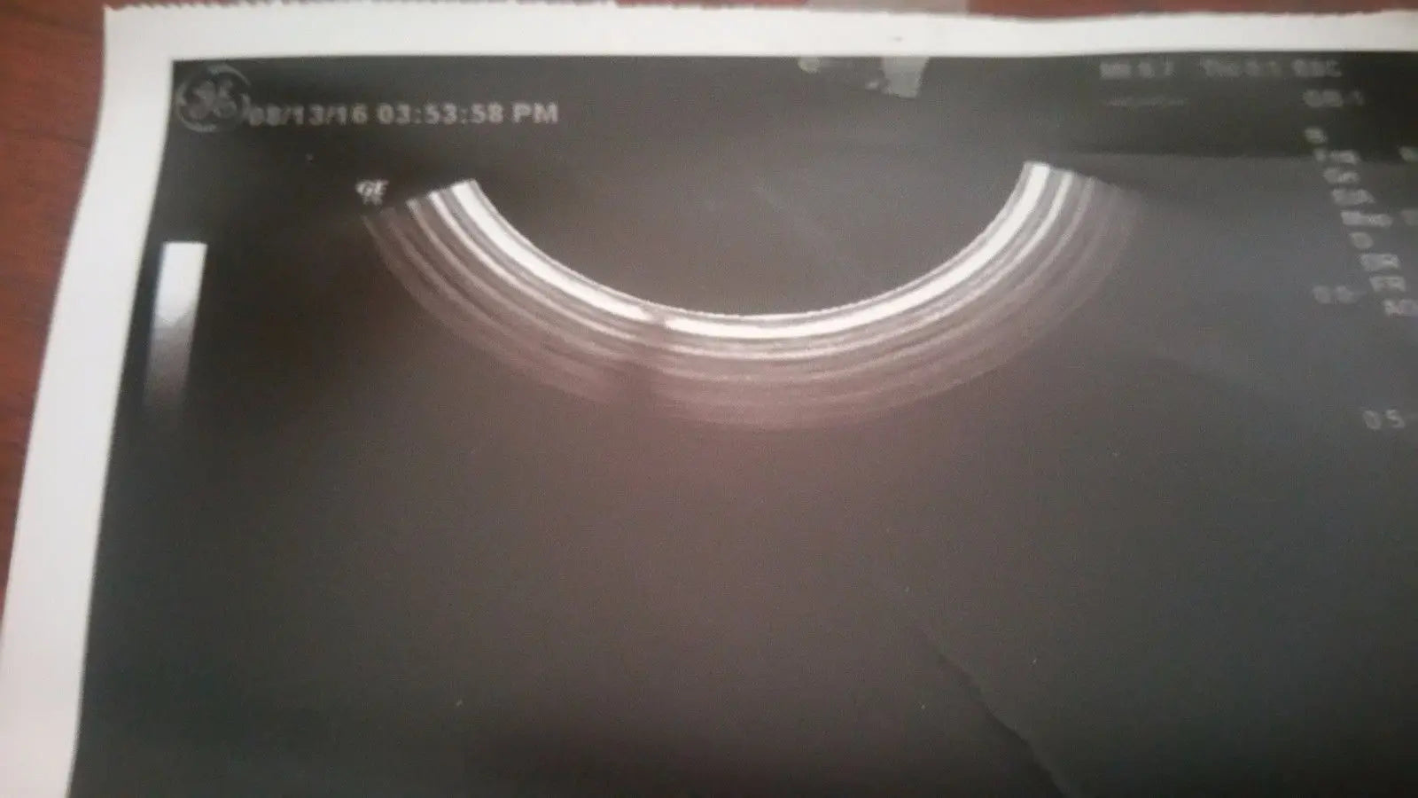 GE E8C Ultrasound Transducer Probe DIAGNOSTIC ULTRASOUND MACHINES FOR SALE