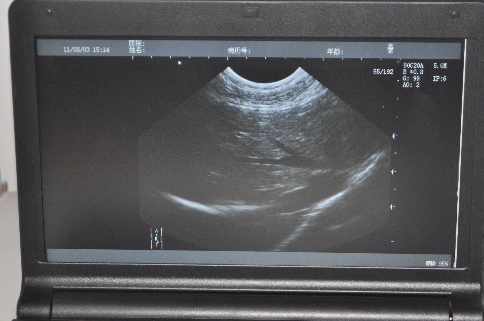 Digital Portable Ultrasound Machine Scanner Convex Probe+ 3D Oximeter 1024 Image DIAGNOSTIC ULTRASOUND MACHINES FOR SALE