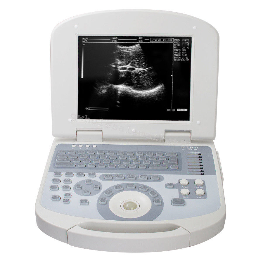 Portable Ultrasound Machine Scanner System Convex probe 3D Software Best Image 190891045898 DIAGNOSTIC ULTRASOUND MACHINES FOR SALE