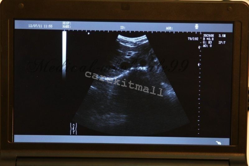 Portable Laptop Digital LCD Testor Ultrasound scanner with Transvaginal Probe CE 190891495471 DIAGNOSTIC ULTRASOUND MACHINES FOR SALE