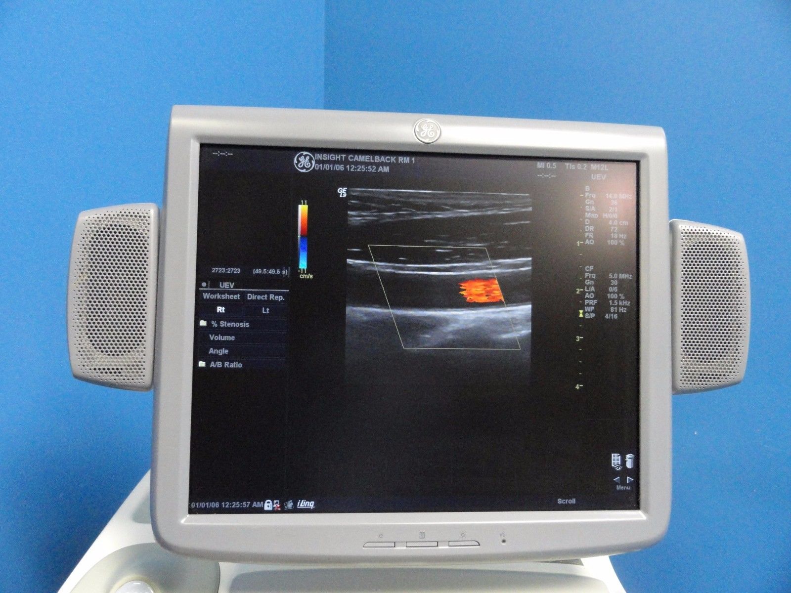 GE Logiq 9 LCD Ultrasound System W/ M12L, 7L, 4C, 4D3C-L Probes & Printer 10369 DIAGNOSTIC ULTRASOUND MACHINES FOR SALE