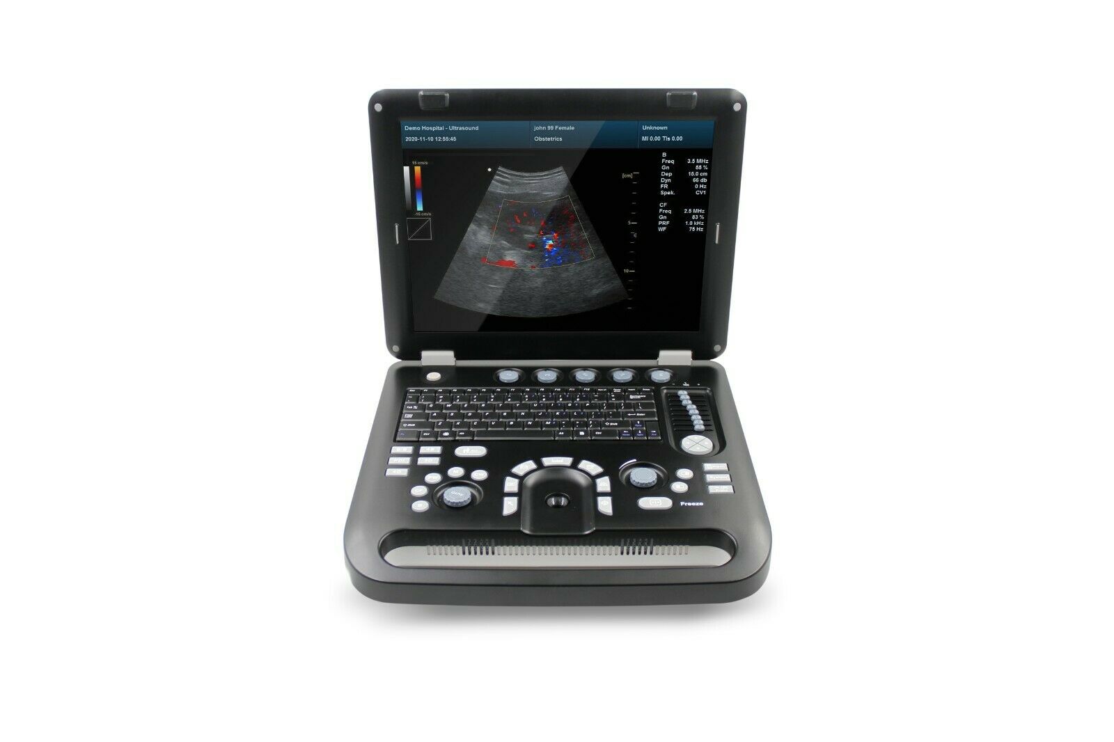 Color Doppler Ultrasound Scanner Portable Laptop Machine 3.5Mhz Convex Probe 6945040100362 DIAGNOSTIC ULTRASOUND MACHINES FOR SALE