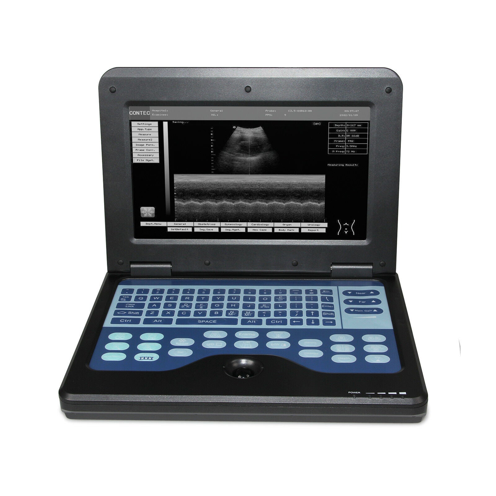 Portable Laptop Ultrasound Scanner + Convex/Linear/Cardiac/Transvaginal 4 probes DIAGNOSTIC ULTRASOUND MACHINES FOR SALE