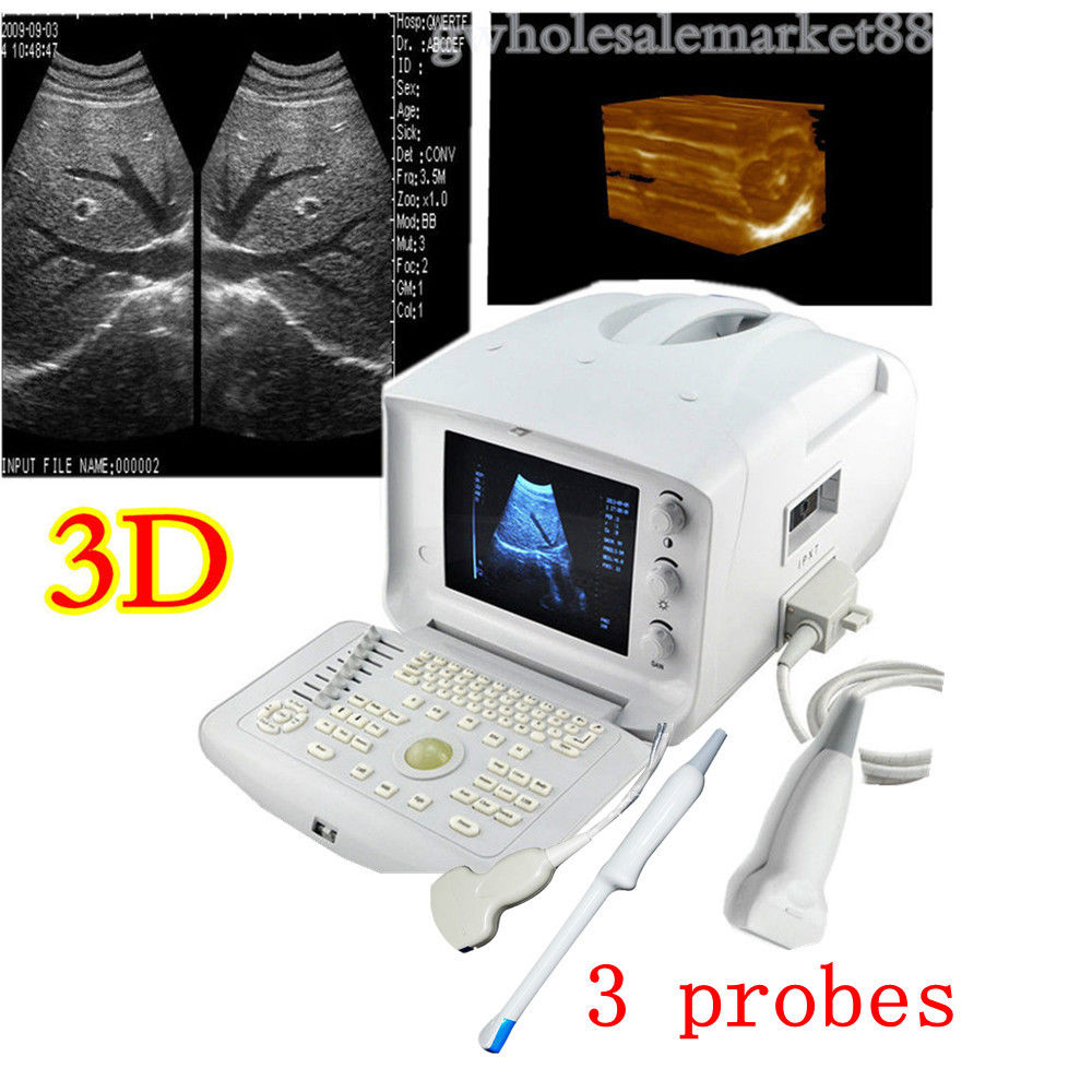 Medical 3D Portable Ultrasound Diagnose Scanner Convex Linear transvaginal Probe DIAGNOSTIC ULTRASOUND MACHINES FOR SALE
