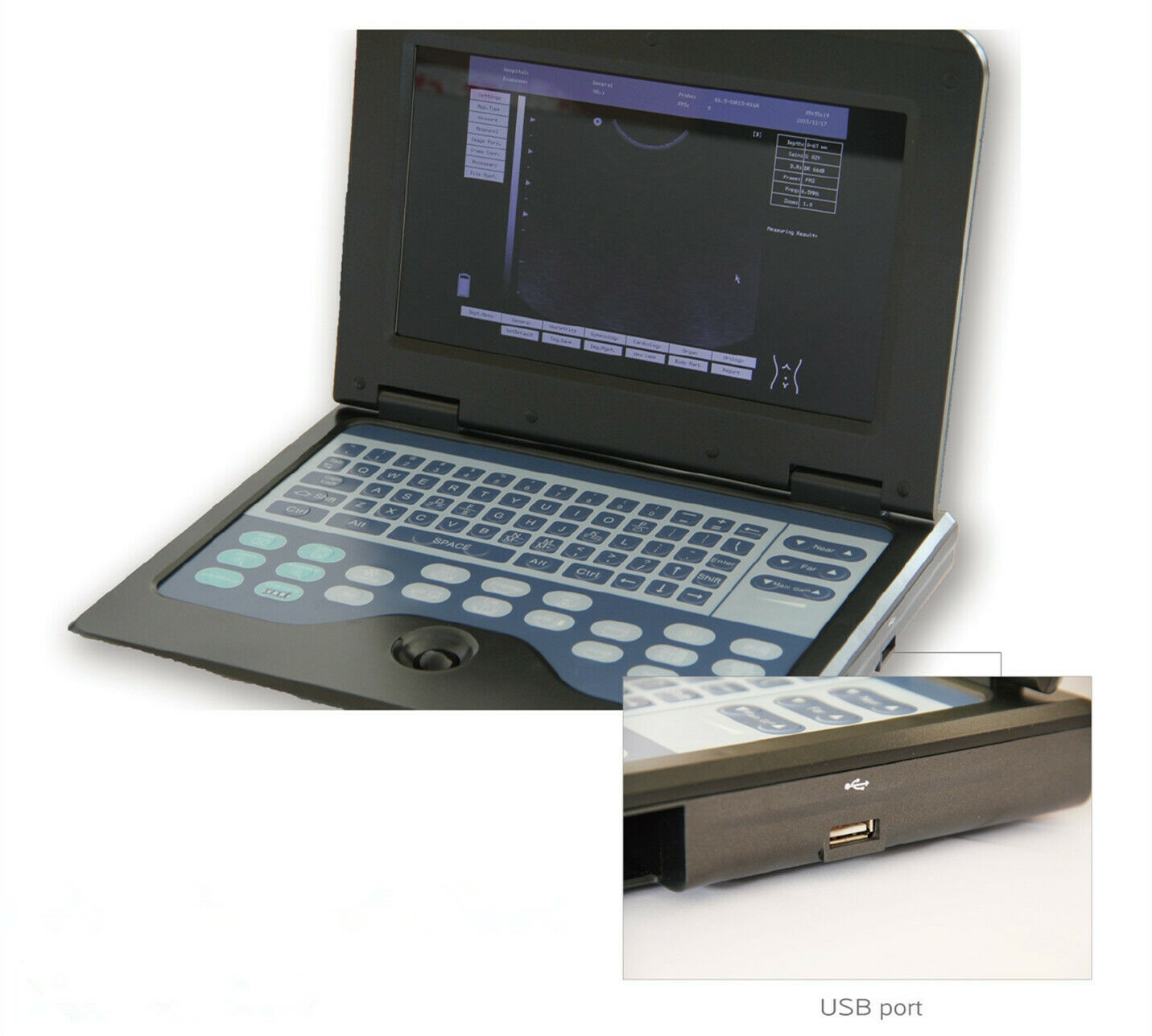 Digital Ultrasound Scanner with 7.5MHz Linear Probe Laptop B-Ultrasound Machine DIAGNOSTIC ULTRASOUND MACHINES FOR SALE