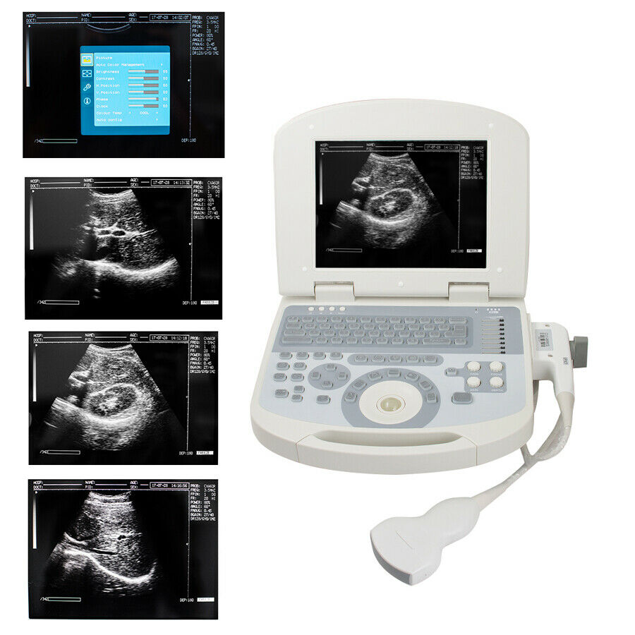 Digital Medical Ultrasound Scanner With 3.5MHZ Convex Probe 3D Image Pregnancy DIAGNOSTIC ULTRASOUND MACHINES FOR SALE