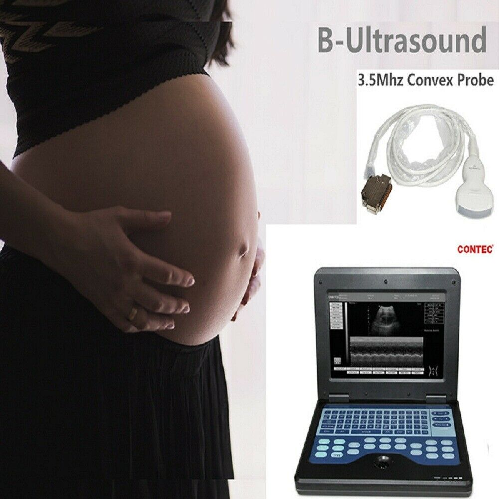 Digital Portable Ultrasound Machine Laptop Scanner with 3.5Mhz Convex Probe CE 6945040100362 DIAGNOSTIC ULTRASOUND MACHINES FOR SALE