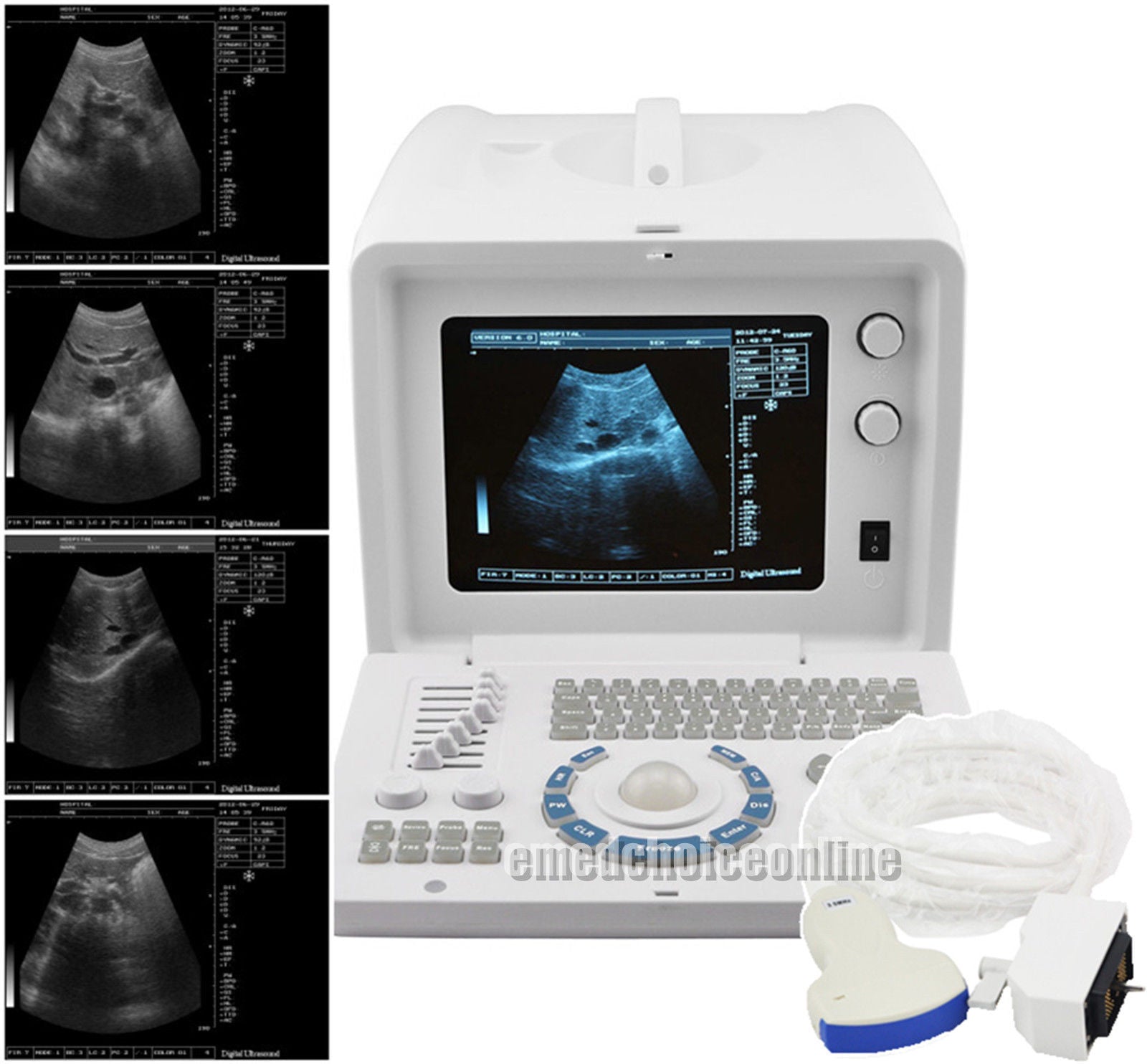 Excellent 10"Digital Ultrasound Machine Covex/ Linear/ Transvaginal 3 Probes USB 190891670403 DIAGNOSTIC ULTRASOUND MACHINES FOR SALE