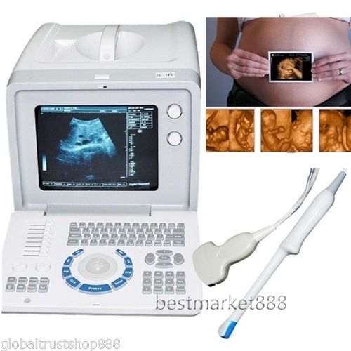 Full Digital Ultrasound Machine Scanner Convex Transvaginal Probes + 3D Medical DIAGNOSTIC ULTRASOUND MACHINES FOR SALE