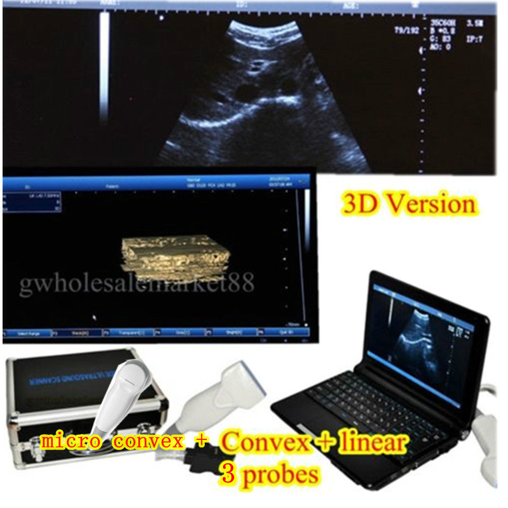 Digital Laptop Ultrasound Scanner Machine Convex+micro convex +Linear 3D 3 Probe 190891055842 DIAGNOSTIC ULTRASOUND MACHINES FOR SALE
