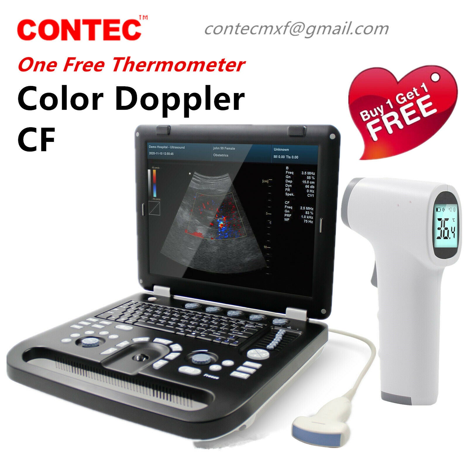 Color Doppler Ultrasound Scanner Portable Laptop Machine 3.5Mhz Convex Probe 6945040100362 DIAGNOSTIC ULTRASOUND MACHINES FOR SALE