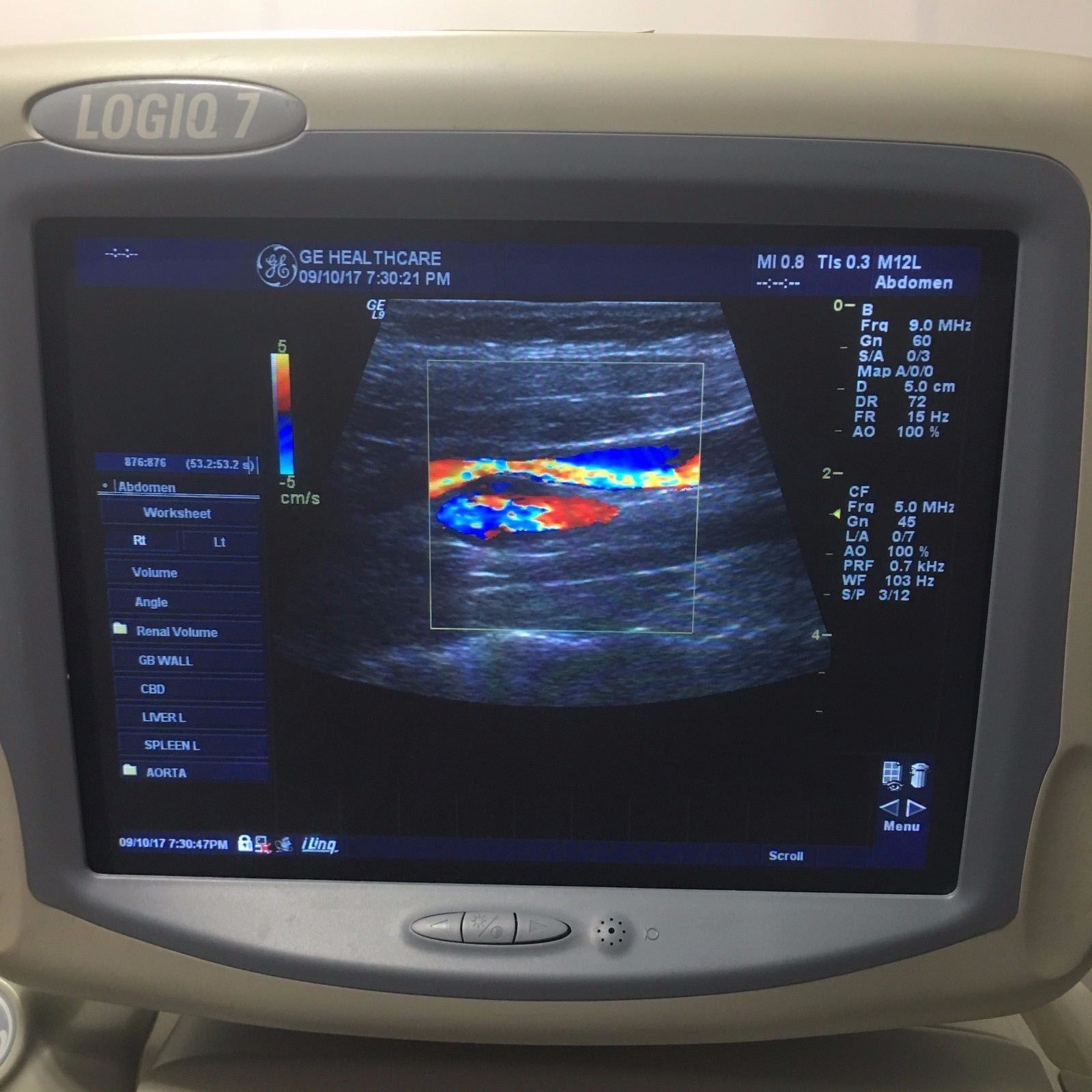 GE Logiq 9 Ultrasound System with 3.5C, E8C, 7L, 10L, and M12L Transducers DIAGNOSTIC ULTRASOUND MACHINES FOR SALE