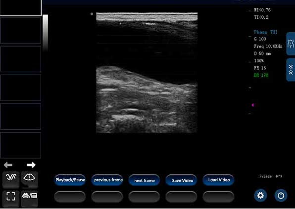 ECO-14Vet High end Equine Ultrasound with Rectal Probe DIAGNOSTIC ULTRASOUND MACHINES FOR SALE