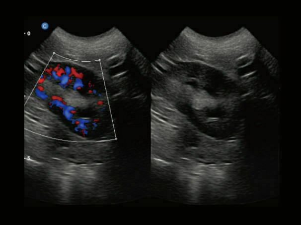 Chison eBit50Vet Veterinary Software Color Doppler High End Portable Ultrasound DIAGNOSTIC ULTRASOUND MACHINES FOR SALE