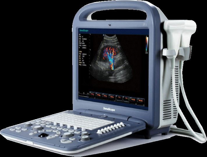 Sonoscape S2 Color Doppler Portable Ultrasound & Linear Array Probe L741 Demo DIAGNOSTIC ULTRASOUND MACHINES FOR SALE