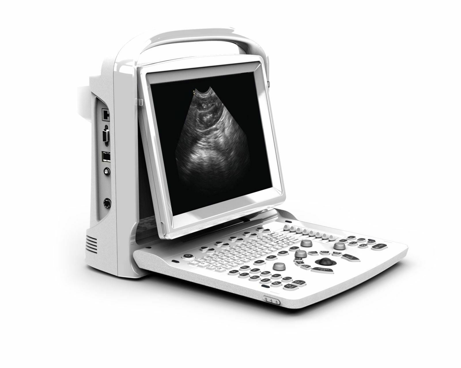 Portable Ultrasound, Chison ECO3, Amazing Quality with Two Probes DIAGNOSTIC ULTRASOUND MACHINES FOR SALE