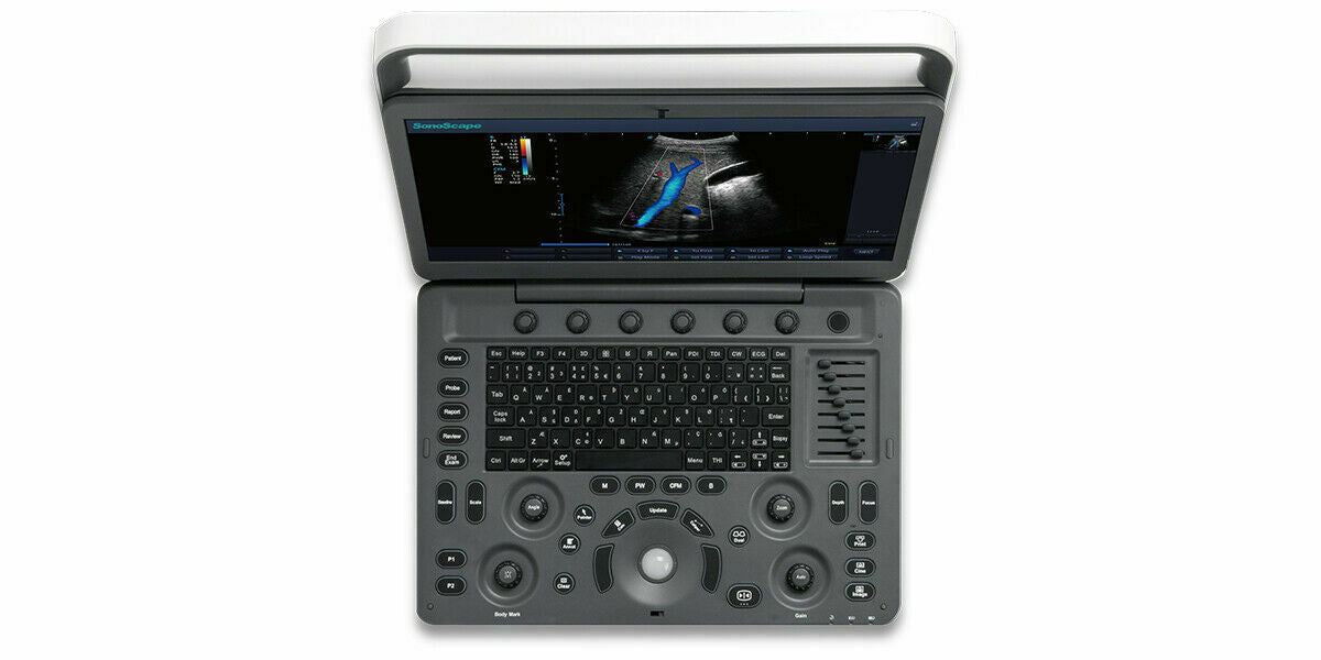 Demo SonoScape E2 Ultrasound with One Linear Array Probe DIAGNOSTIC ULTRASOUND MACHINES FOR SALE