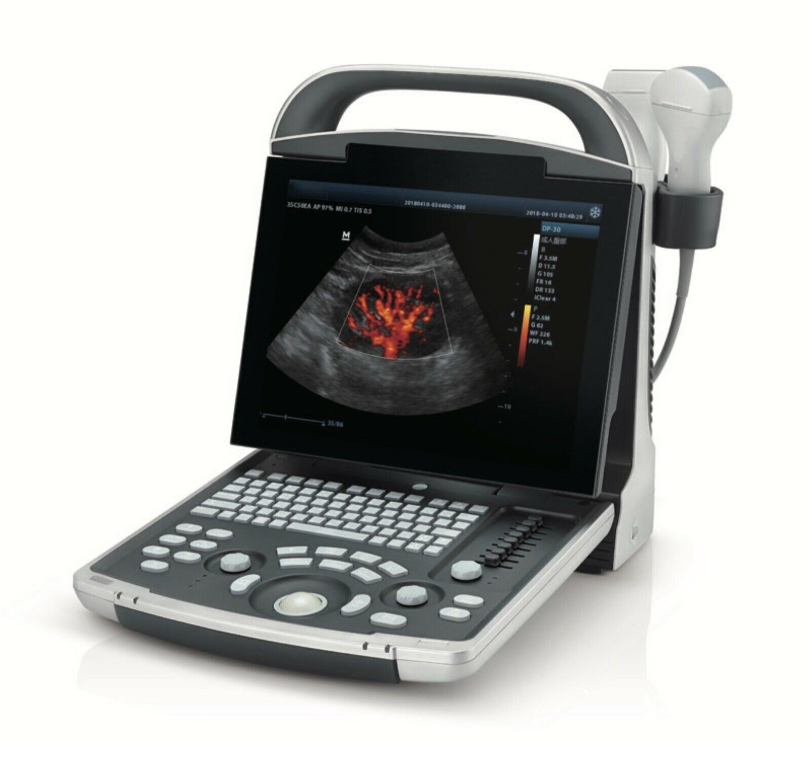 Most Affordable Color Doppler Ultrasound with One Probe LED,THI DIAGNOSTIC ULTRASOUND MACHINES FOR SALE