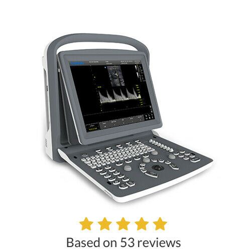 Color Doppler Portable Ultrasound Chison ECO5 with two probes Convex and Linear DIAGNOSTIC ULTRASOUND MACHINES FOR SALE