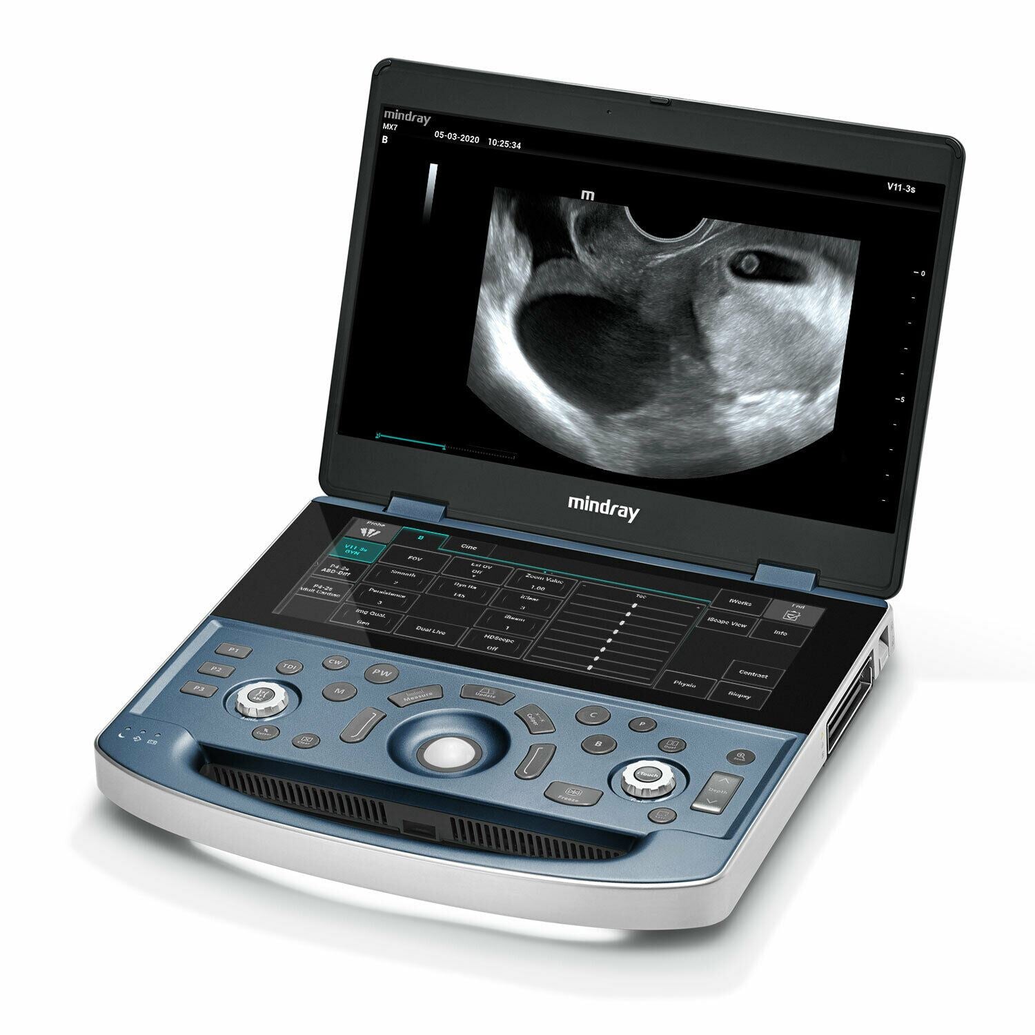 Mindray Advanced MX7 CW Ultrasound With Cardiac and Vascular probes- Stress DIAGNOSTIC ULTRASOUND MACHINES FOR SALE