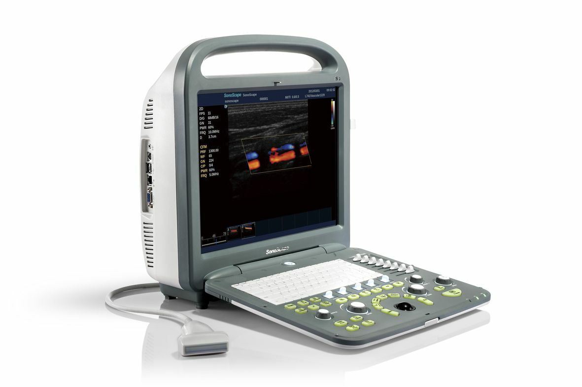 SonoScape S2 with convex Probe Abdominal Ultrasound DIAGNOSTIC ULTRASOUND MACHINES FOR SALE