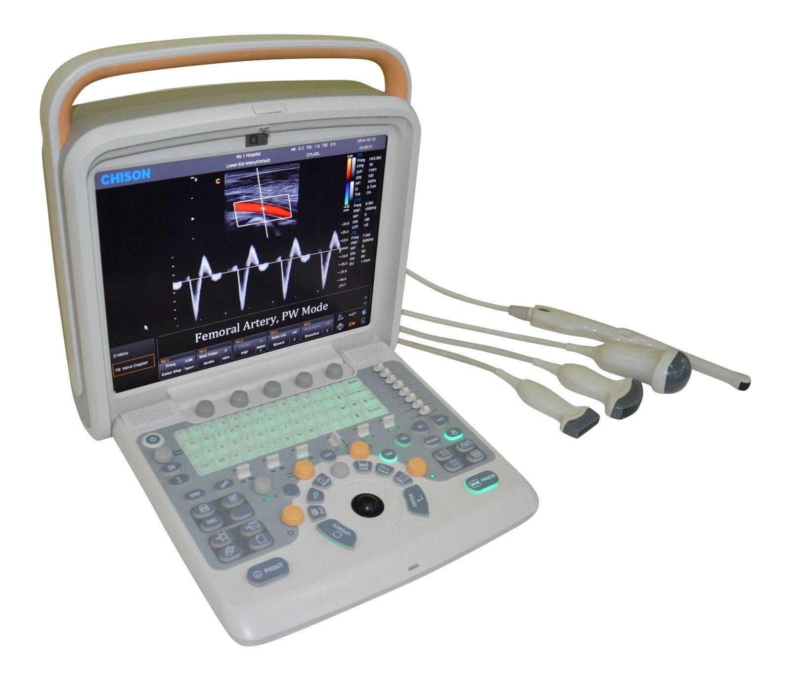 Chison Q5Vet Veterinary Color Doppler Ultrasound Machine, Equipment - Low Price DIAGNOSTIC ULTRASOUND MACHINES FOR SALE