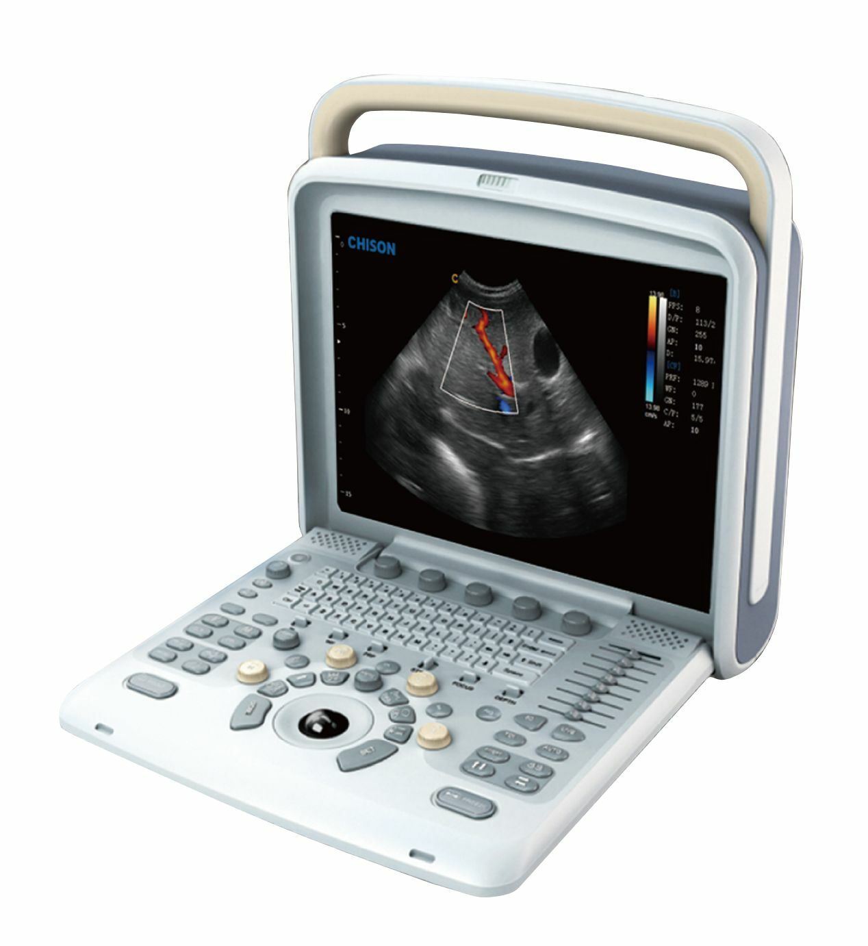 Chison Q5Vet Veterinary Color Doppler Ultrasound Machine, Equipment - Low Price DIAGNOSTIC ULTRASOUND MACHINES FOR SALE