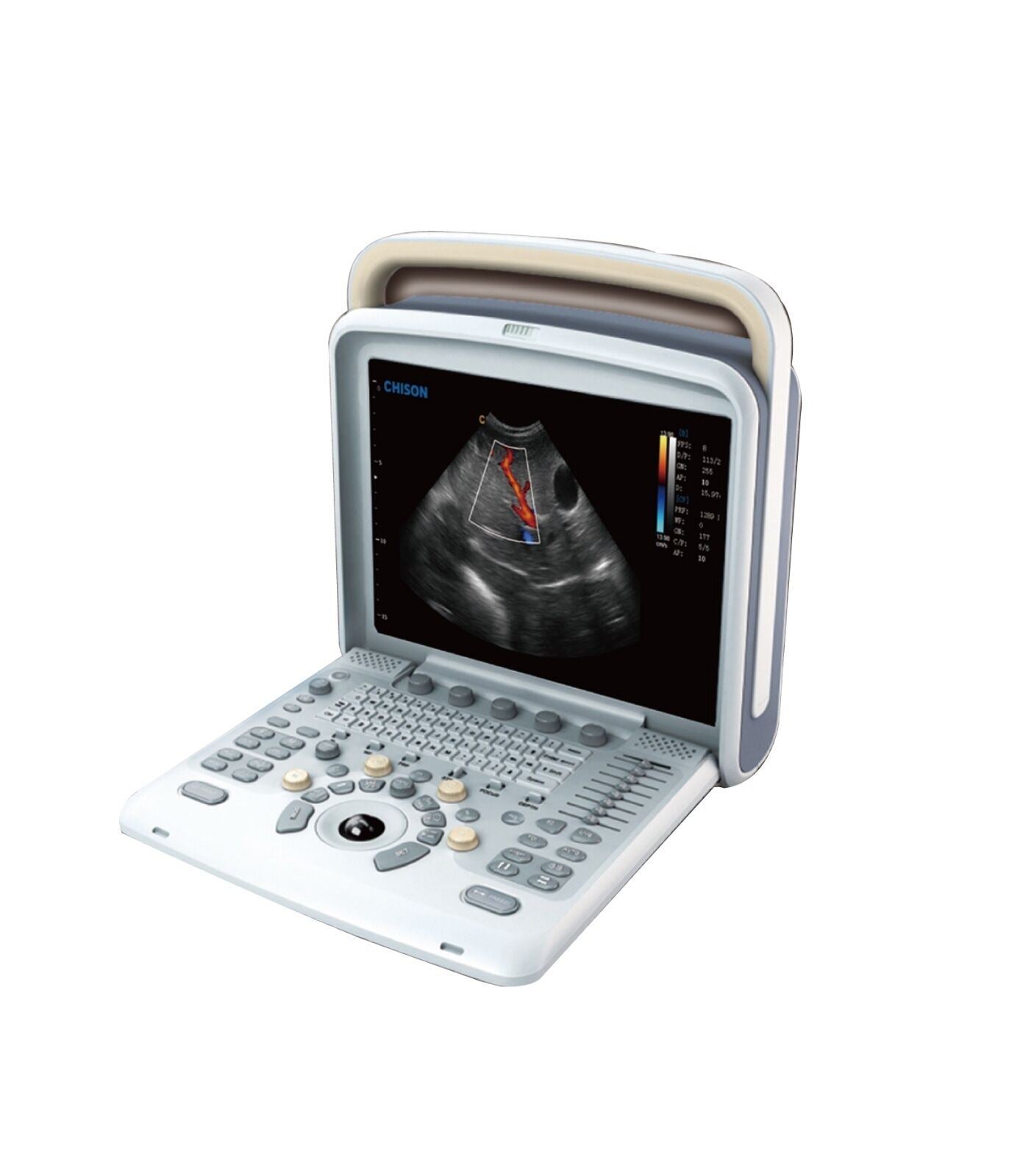 Chison Q5Vet Veterinary Color Doppler Ultrasound Machine, Equipment - Low Price DIAGNOSTIC ULTRASOUND MACHINES FOR SALE