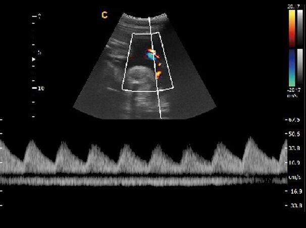 Veterinary Ultrasound Chison Q9 Color Doppler & Micro-Convex Small Animals Probe DIAGNOSTIC ULTRASOUND MACHINES FOR SALE