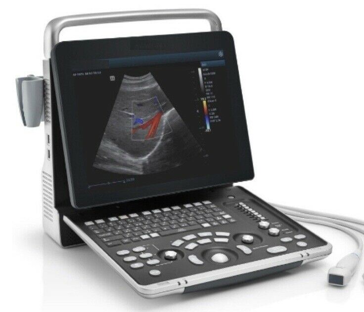 Newest- Color Portable Ultrasound & One phased Array Probe, CW, TDI DIAGNOSTIC ULTRASOUND MACHINES FOR SALE