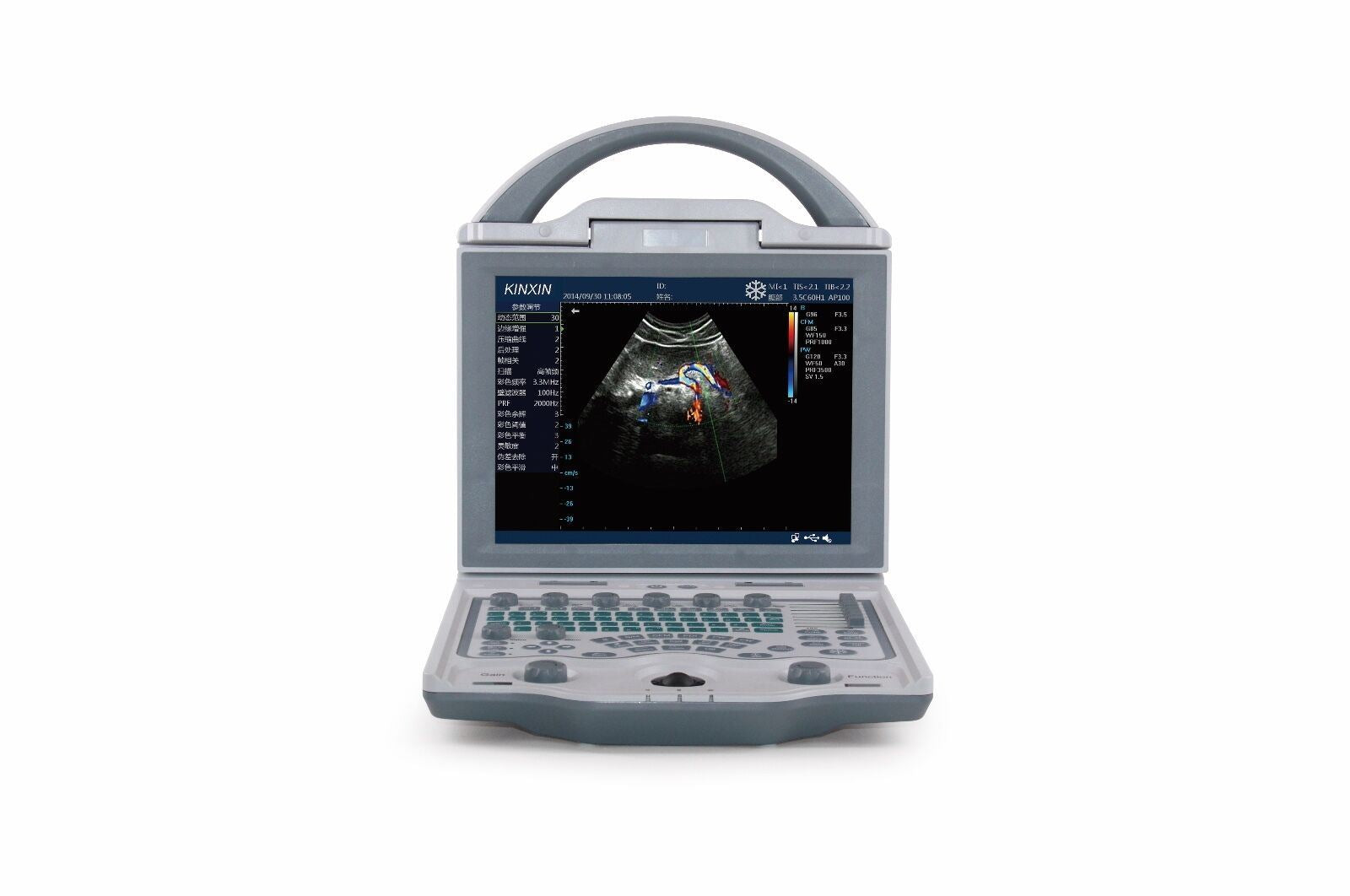 Color Doppler Ultrasound Scanner with one  Probe DIAGNOSTIC ULTRASOUND MACHINES FOR SALE