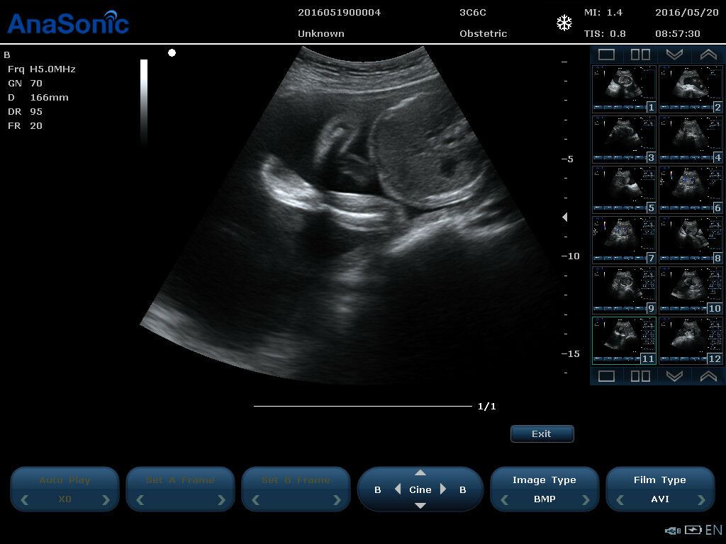 Highest quality Virtual 4D Ultrasound Chison Ebit 30 DIAGNOSTIC ULTRASOUND MACHINES FOR SALE