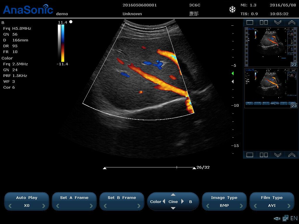 Highest quality Virtual 4D Ultrasound Chison Ebit 30 DIAGNOSTIC ULTRASOUND MACHINES FOR SALE