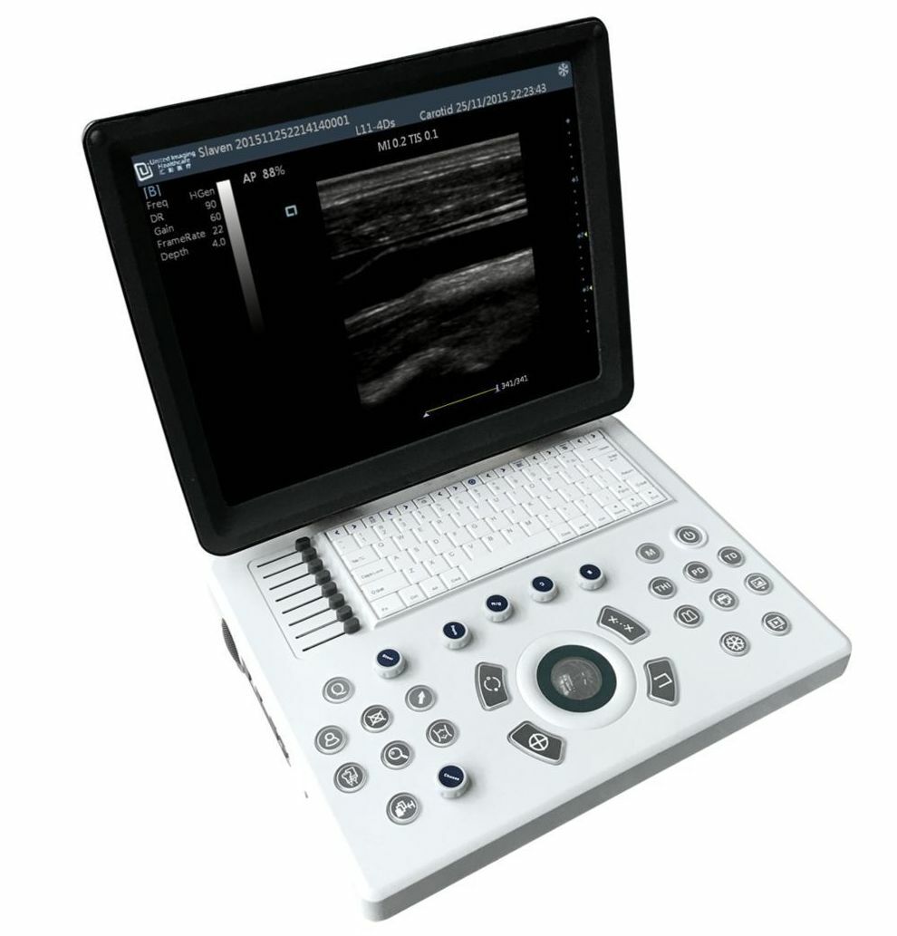 Quality DP30 Veterinary Ultrasound 12" Screen & Rectal Probe, 50L60EAV DIAGNOSTIC ULTRASOUND MACHINES FOR SALE