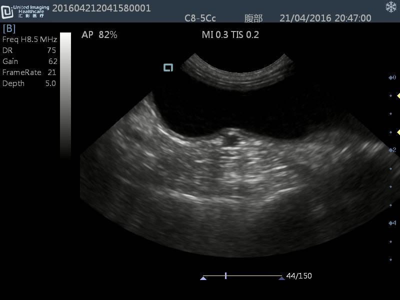 Quality DP30 Veterinary Ultrasound 12" Screen & Rectal Probe, 50L60EAV DIAGNOSTIC ULTRASOUND MACHINES FOR SALE