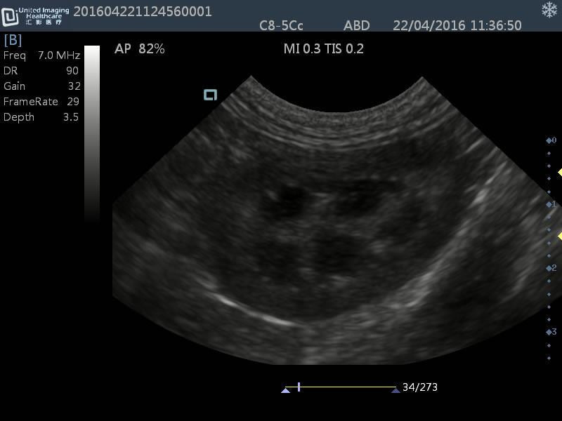 Quality DP30 Veterinary Ultrasound 12" Screen & Rectal Probe, 50L60EAV DIAGNOSTIC ULTRASOUND MACHINES FOR SALE