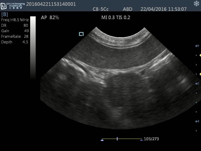 Quality DP30 Veterinary Ultrasound 12" Screen & Rectal Probe, 50L60EAV DIAGNOSTIC ULTRASOUND MACHINES FOR SALE