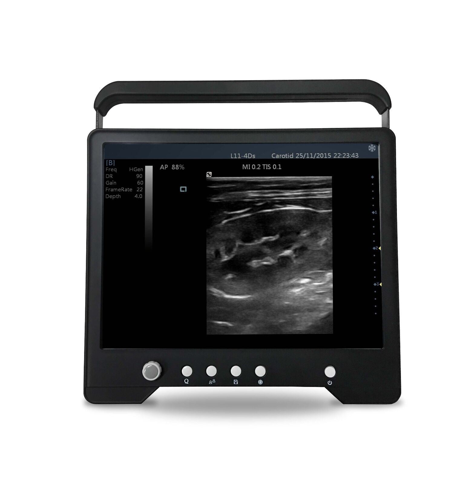 Veterinario Touchscreen Ultrasound&micro-convex Sonda per S Animali, Keebomed DIAGNOSTIC ULTRASOUND MACHINES FOR SALE