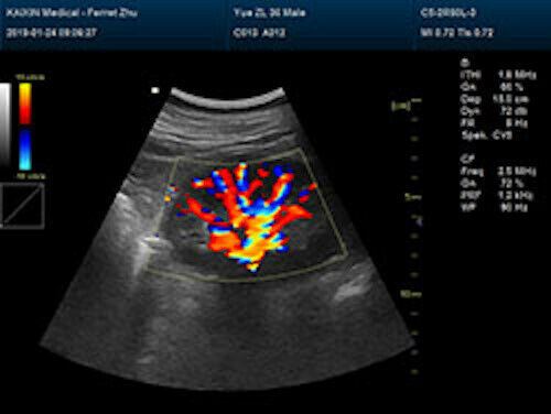 Newest- Farbe Tragbar Ultraschall & Ein Sonde, Dicom , LED Display DIAGNOSTIC ULTRASOUND MACHINES FOR SALE