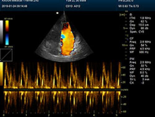 Newest- Farbe Tragbar Ultraschall & Ein Sonde, Dicom , LED Display DIAGNOSTIC ULTRASOUND MACHINES FOR SALE