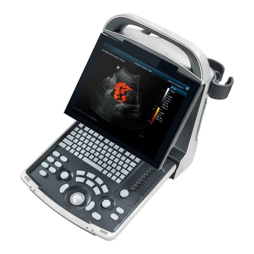 Erschwingliche Farbe Doppler Ultraschall Zwei Sonden Konvex & Lineare Anordnung DIAGNOSTIC ULTRASOUND MACHINES FOR SALE