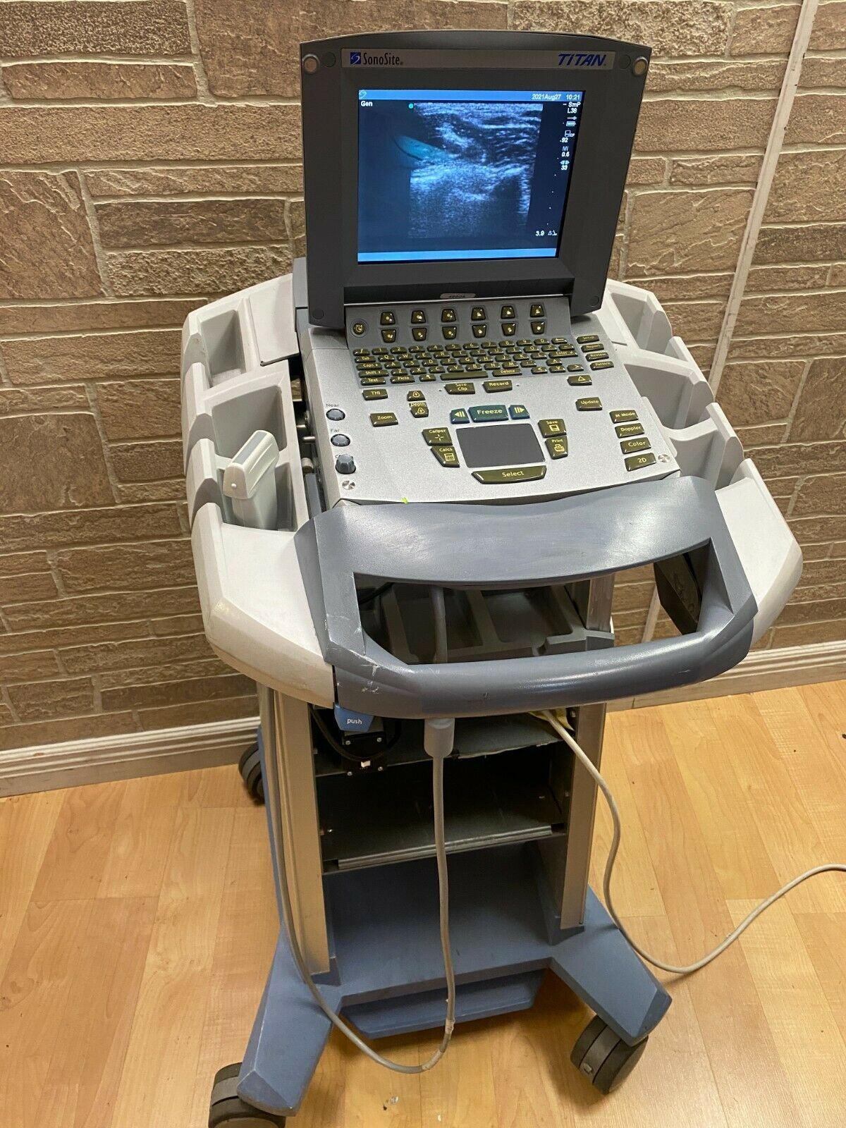 SONOSITE TITAN PORTABLE ULTRASOUND MACHINE WITH 1 PROBE (L38) 08/2004 DIAGNOSTIC ULTRASOUND MACHINES FOR SALE